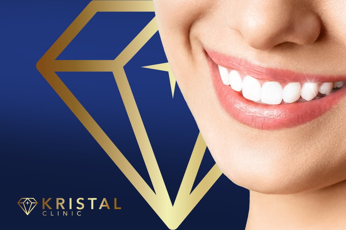 Hollywood Smile