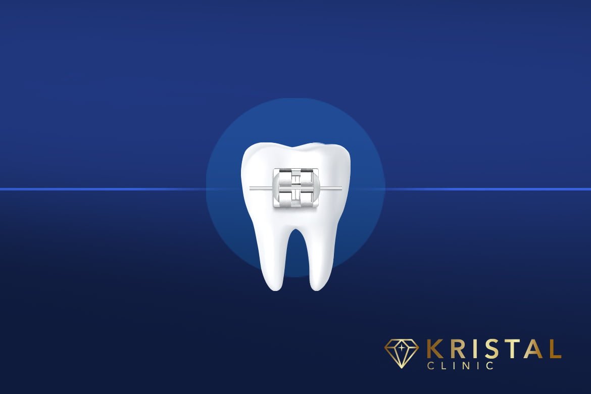  Orthodontics