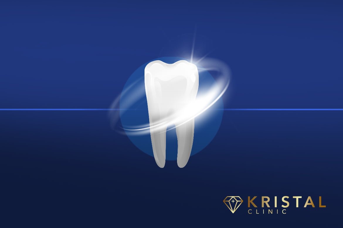Teeth Whitening