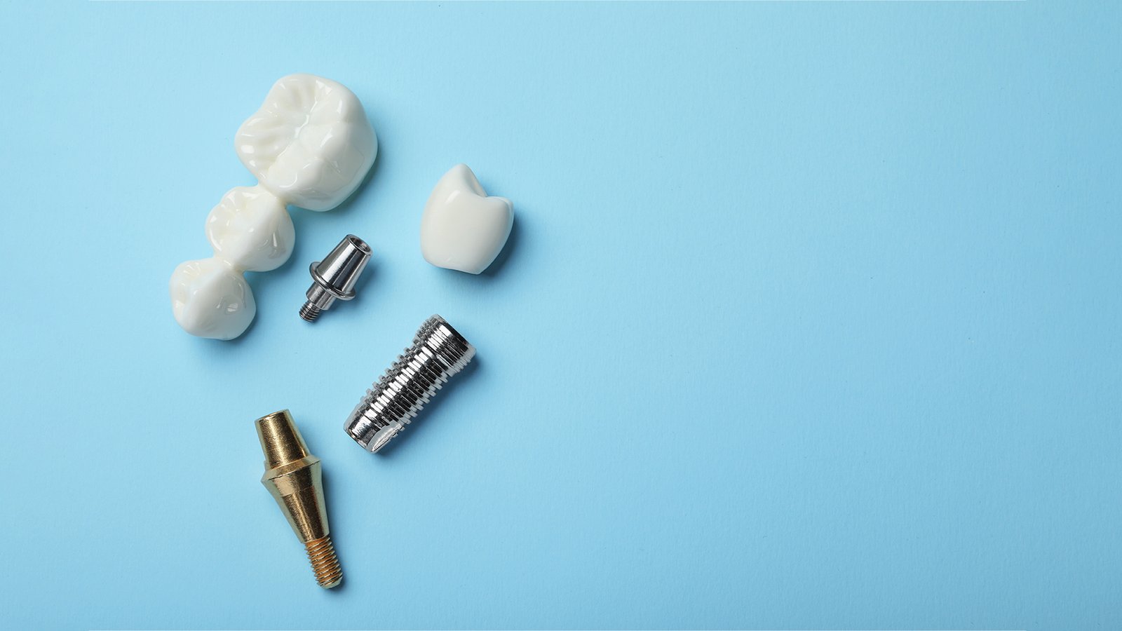 what types of dental implants ?