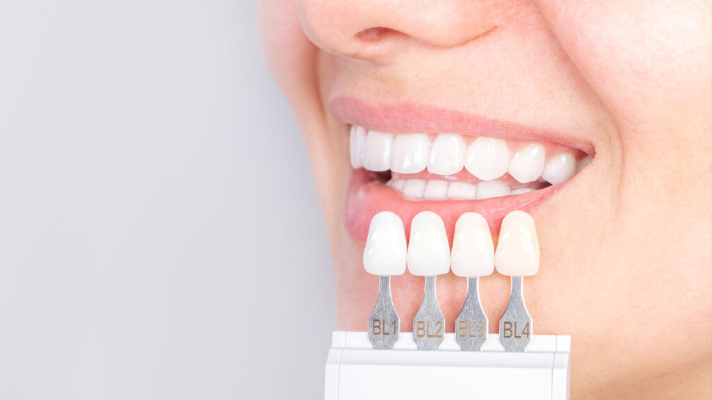 Exploring Different Types of tooth crowns Kristal Clinic