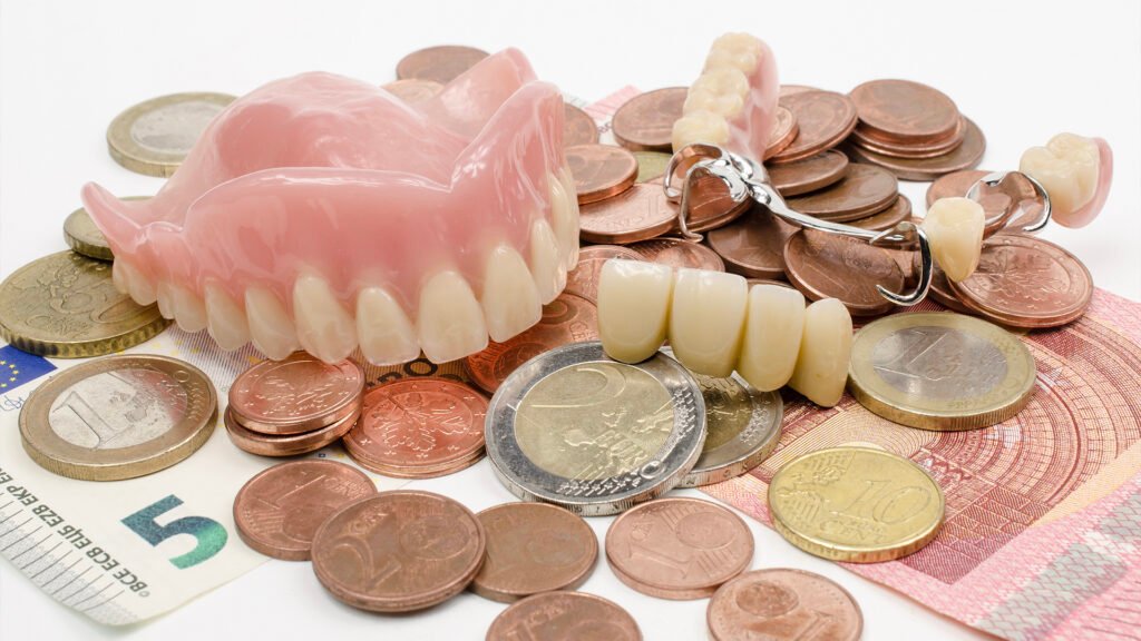 veneers cost