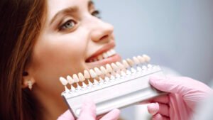 snap on veneers