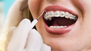 orthodontics