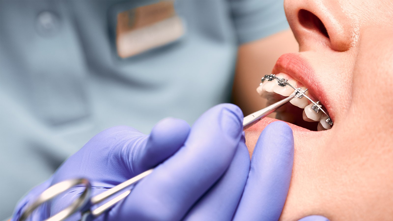 Elevate Your zmile with Kristal Clinic’s exceptional orthodontic treatment