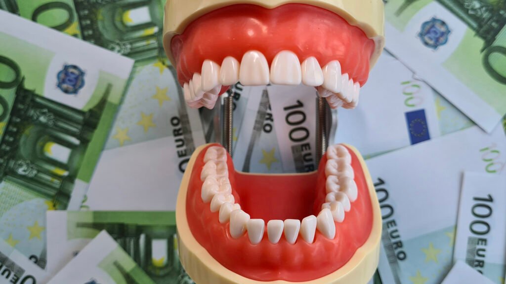 veneers cost