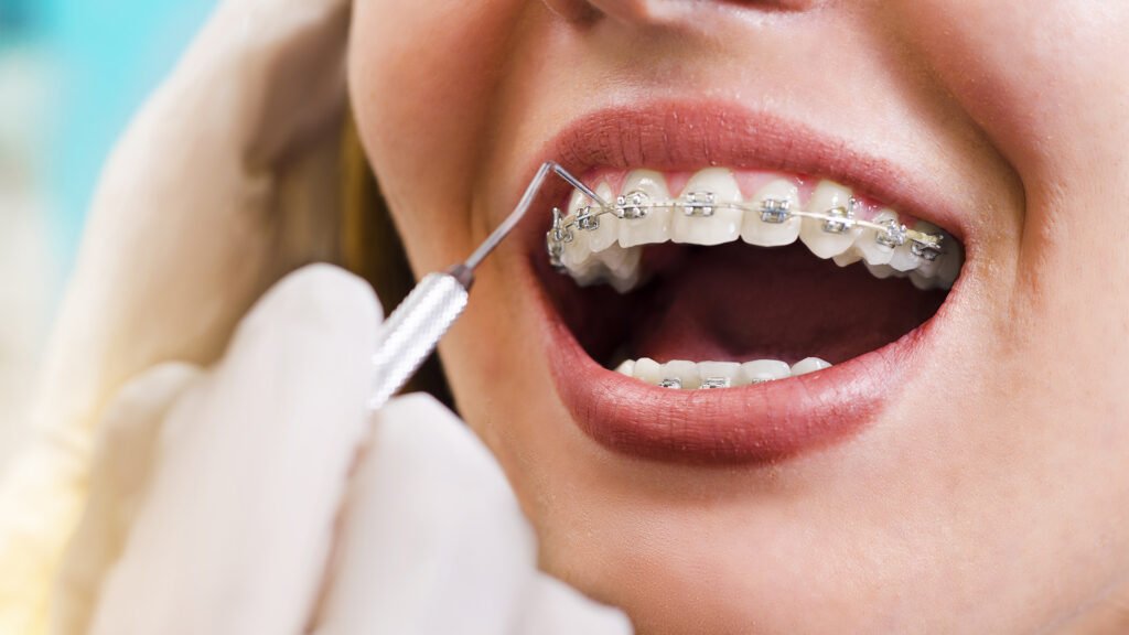 orthodontic treatment