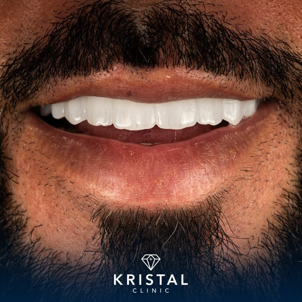 Dental Implant Cost