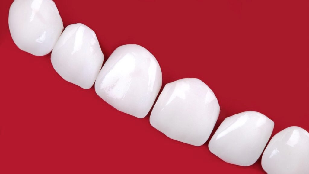 dental crowns