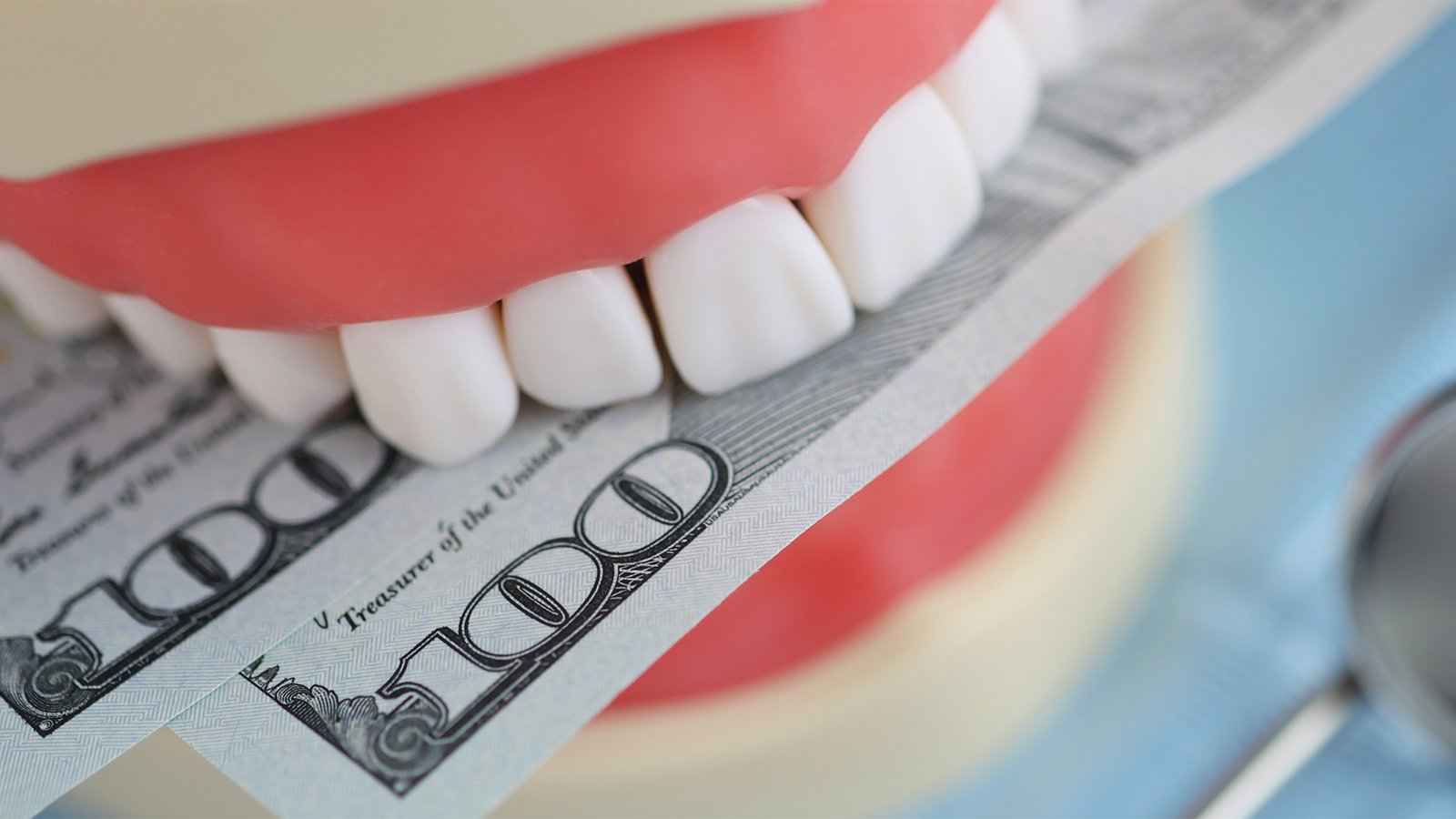 Are veneers cost alot in Turkey?