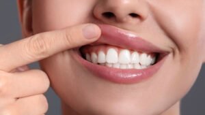 healthy gums