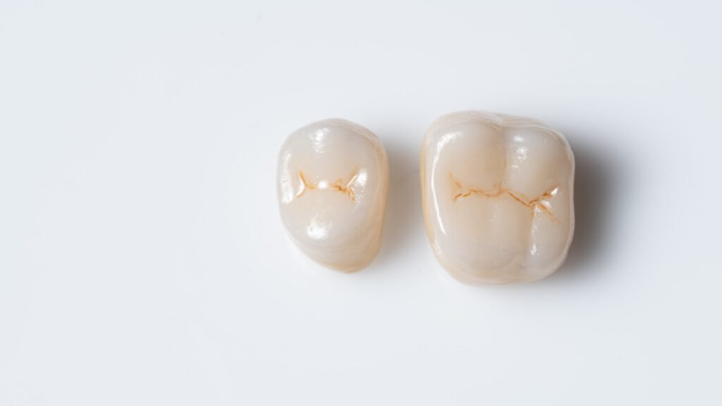 zirconia dental crowns