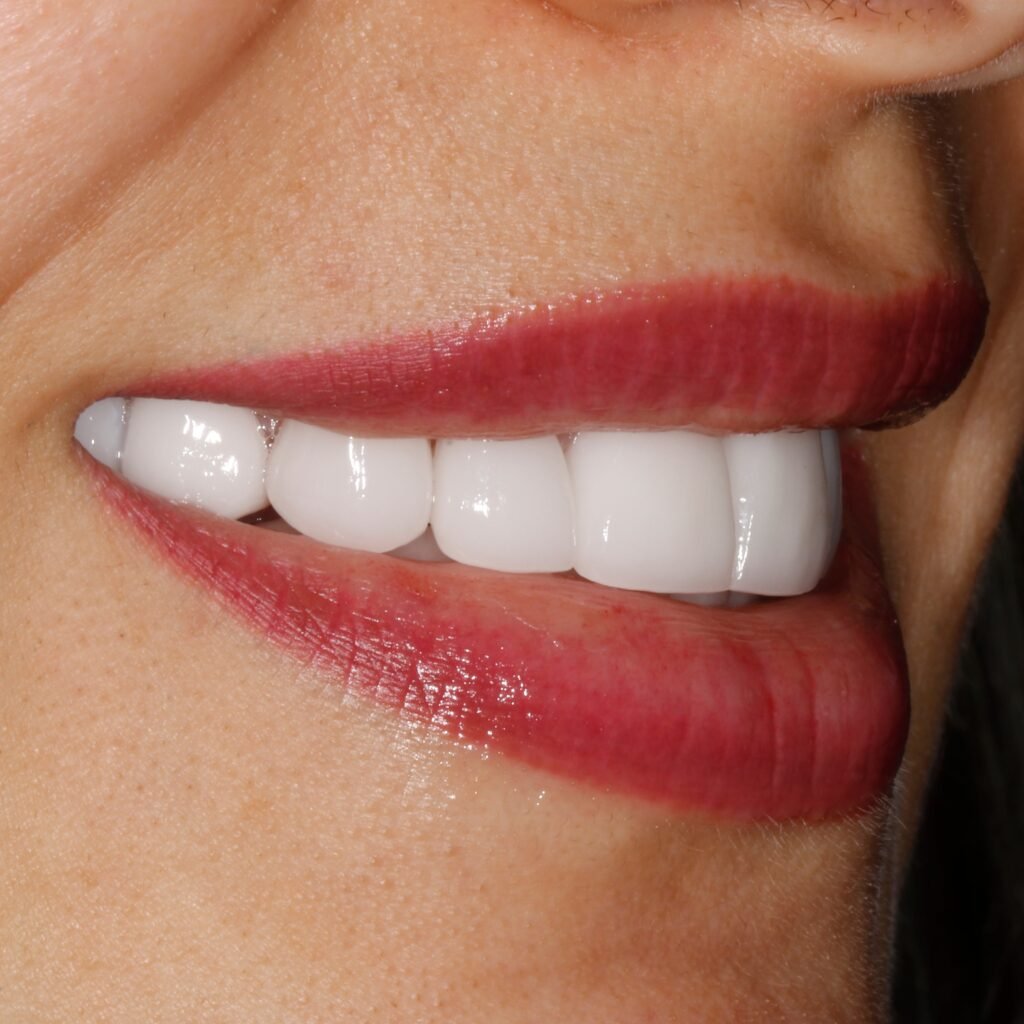 zirconia dental crowns