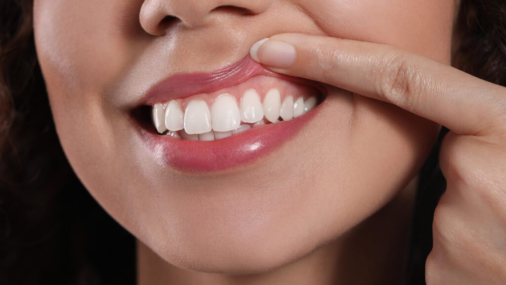 strong gums