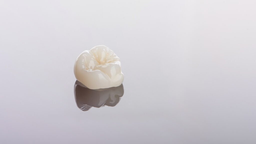 dental crowns for teeth