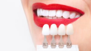hollywood dental clinic