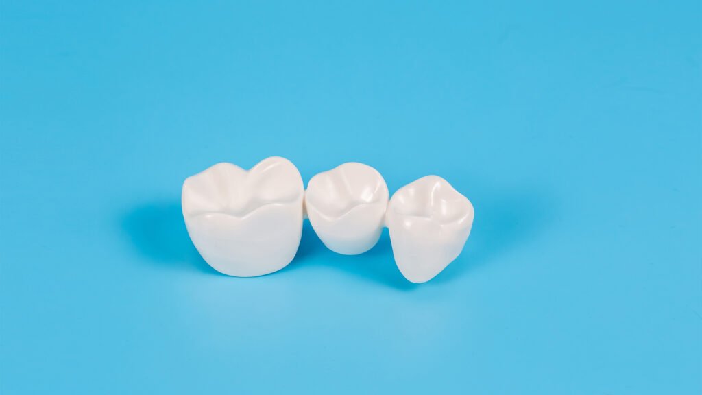 dental crowns for teeth