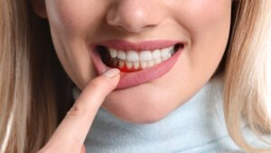 gum disease