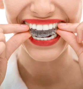 invisalign dental braces