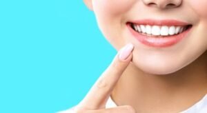 smile direct cost