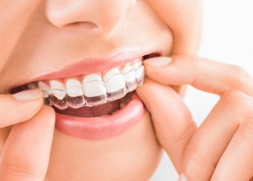 straighten teeth with invisible aligners