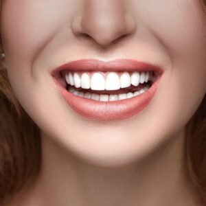 teeth veneers cost