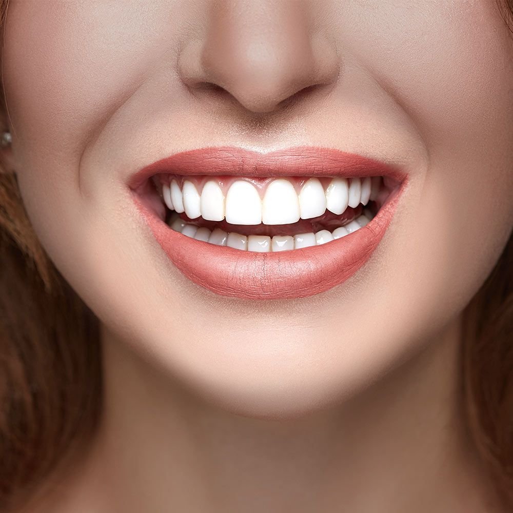 Hollywood Smile Cost in Istanbul vs. Antalya: Where to Go?