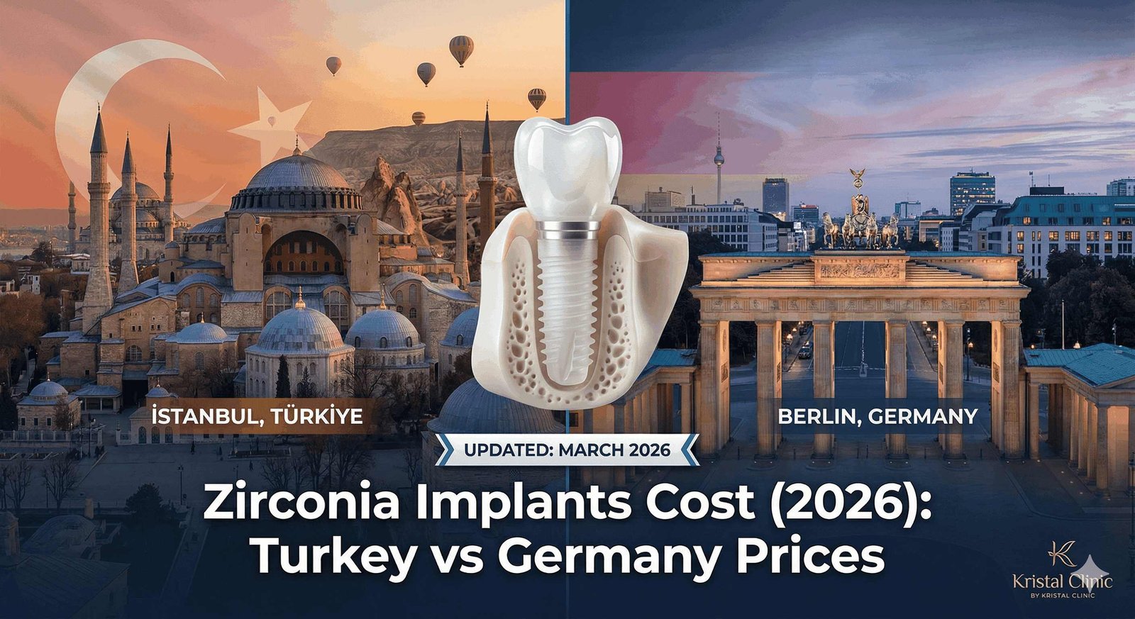 Zirconia Implants Cost 2026: Turkey vs Germany & Global