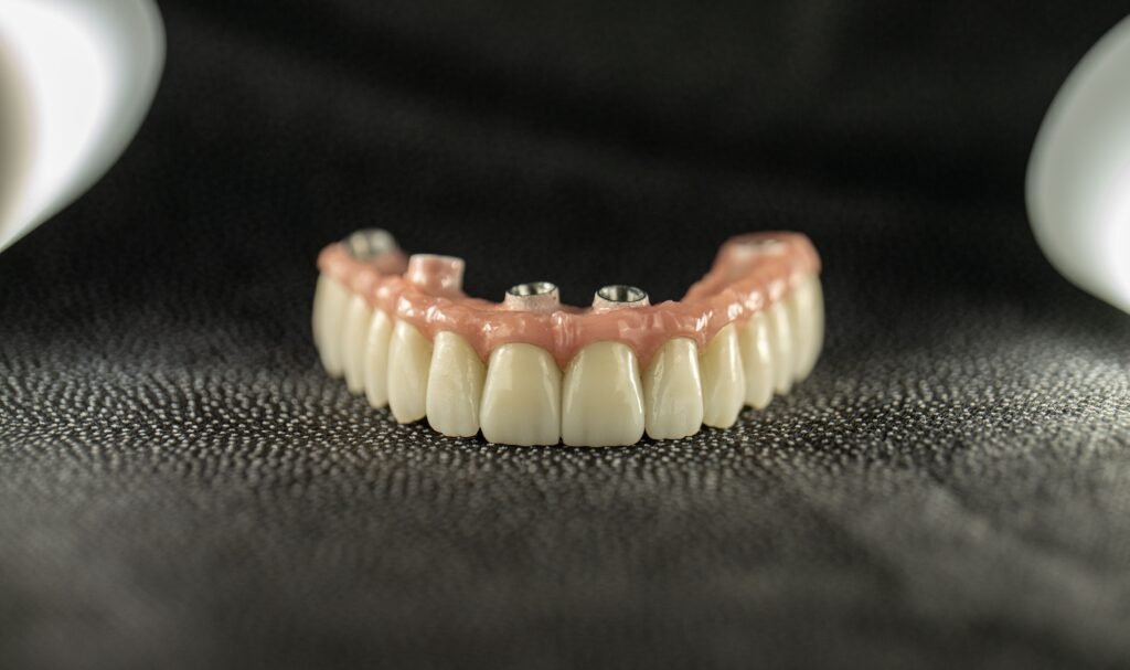 dental implants all on four