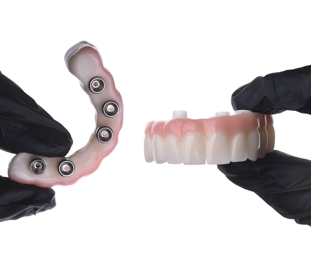 dental implants all on four