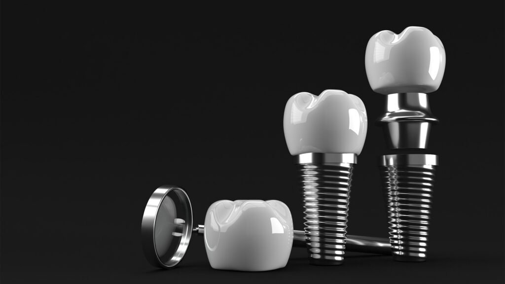 Dental Bone Graft: Cost, Procedure & Treatment Options