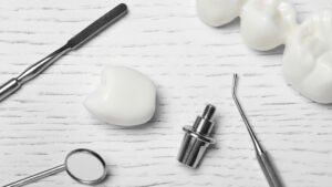 Dental Implants on Front Teeth