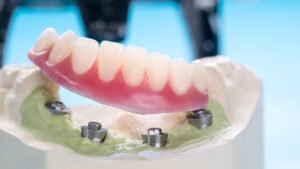 smile dental antalya
