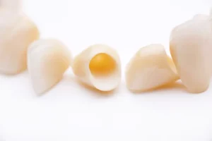 metal zirconia