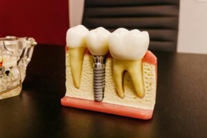 zirconia dental implant manufacturers