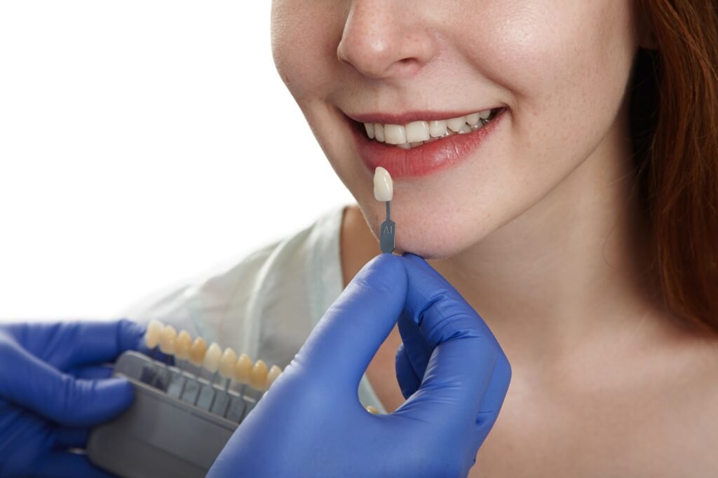 dental cement for crowns