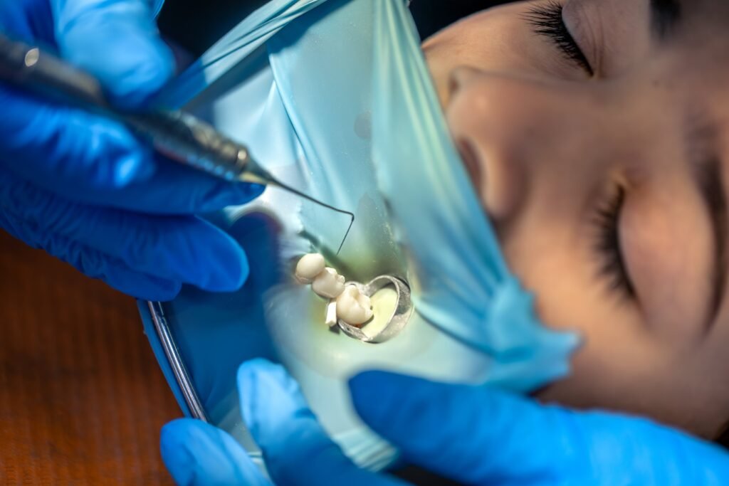bone grafting for dental implants